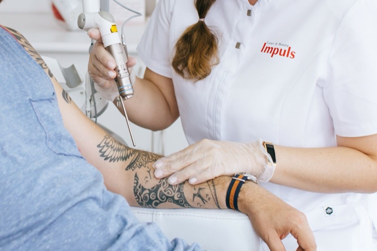 Aclaración de tatuajes · Impuls Longevity Barcelona